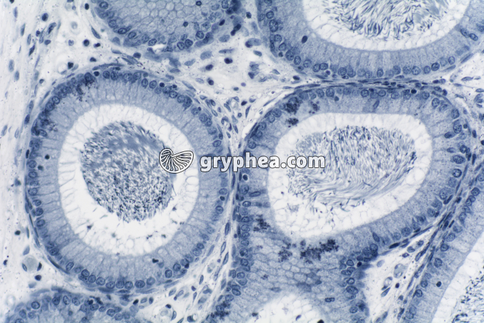 Epididyme x100 - gryphea.com